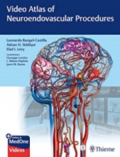 کتاب ویدئو اطلس آف نیورواندوواسکولار پروسیجرز Video Atlas of Neuroendovascular Procedures 1st Edition2020