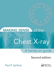 کتاب میکینگ سنس Making Sense of the Chest X-ray: A hands-on guide, 2nd Edition2013